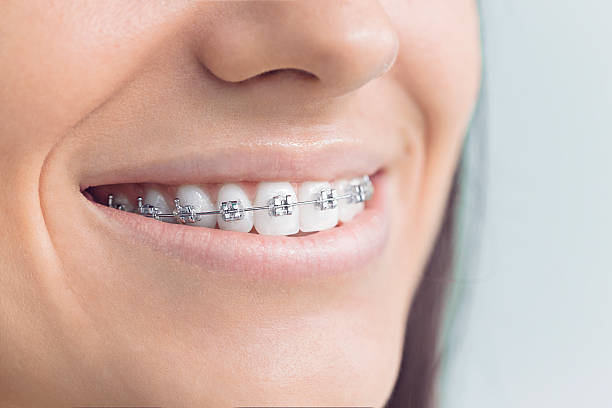 Best Traditional Braces  in Lake Sherwood, CA